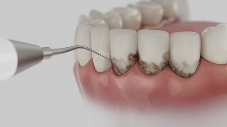 Trusted Tooth Extraction service in Lake Shore, MD - Dentist Open Now